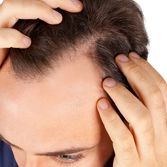 surgical treatments for hair loss