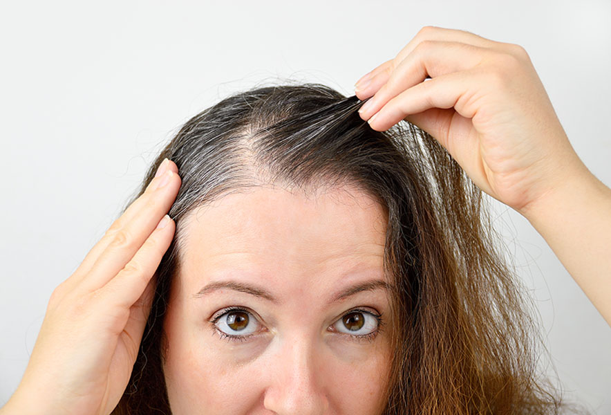 Young woman shows her thinning hair